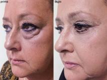 18 luglio Consulenza e Preventivo Chirurgo Estetico 18luglioConsulenzaePreventivoChirurgoEstetico1.jpg 18 luglio Consulenza e Preventivo Chirurgo Estetico 18luglioConsulenzaePreventivoChirurgoEstetico1.jpg